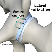 bpc 157 for hip labral tear Treatment in Kirkland & Seattle skincare